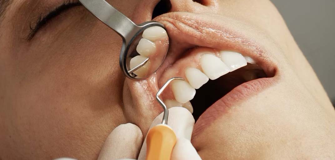 Dental Nursing: a new opportunity for you?